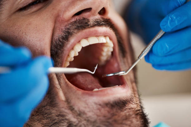 Best Emergency Dentist for Knocked-Out Tooth in Napili Honokowai, HI